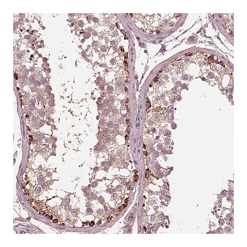 Atlas Antibodies Anti-STK33 Antibody