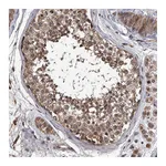 Atlas Antibodies Anti-STK36 Antibody
