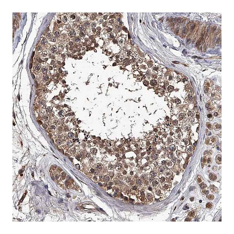 Atlas Antibodies Anti-STK36 Antibody