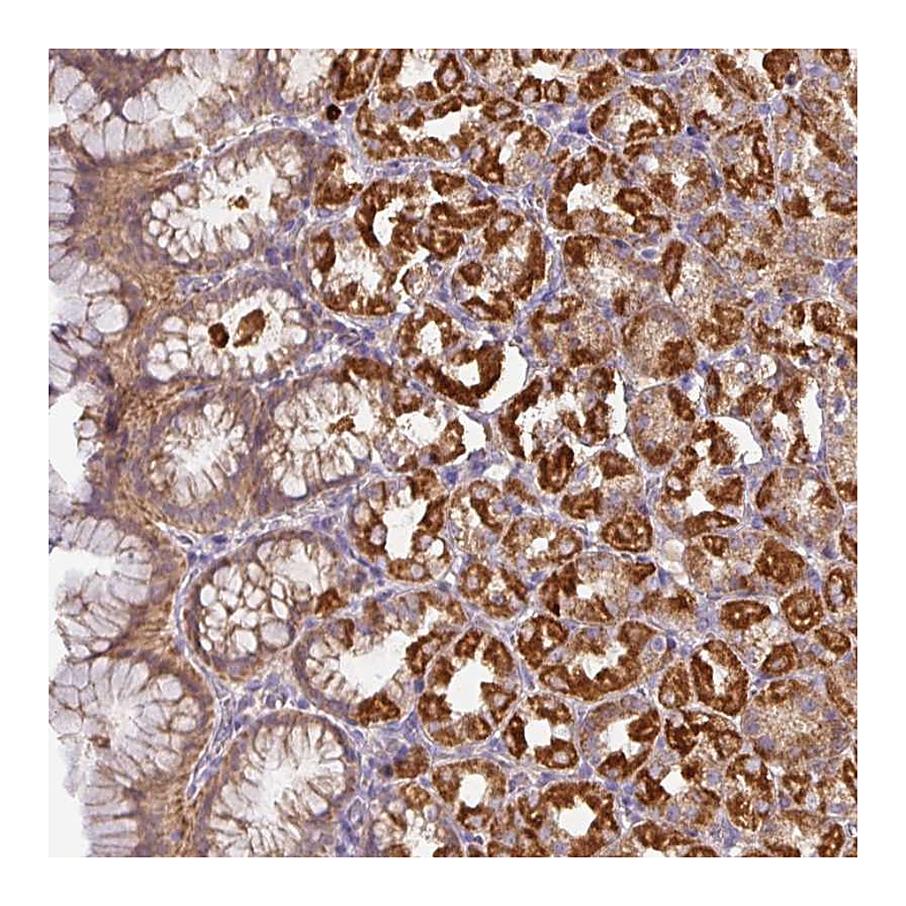 Atlas Antibodies Anti-STK35 Antibody