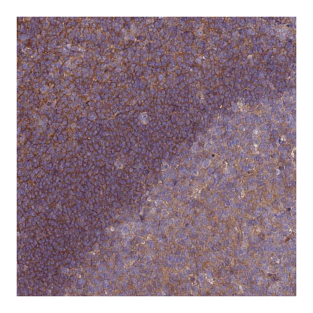 Atlas Antibodies Anti-STK38L Antibody