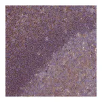 Atlas Antibodies Anti-STK38L Antibody