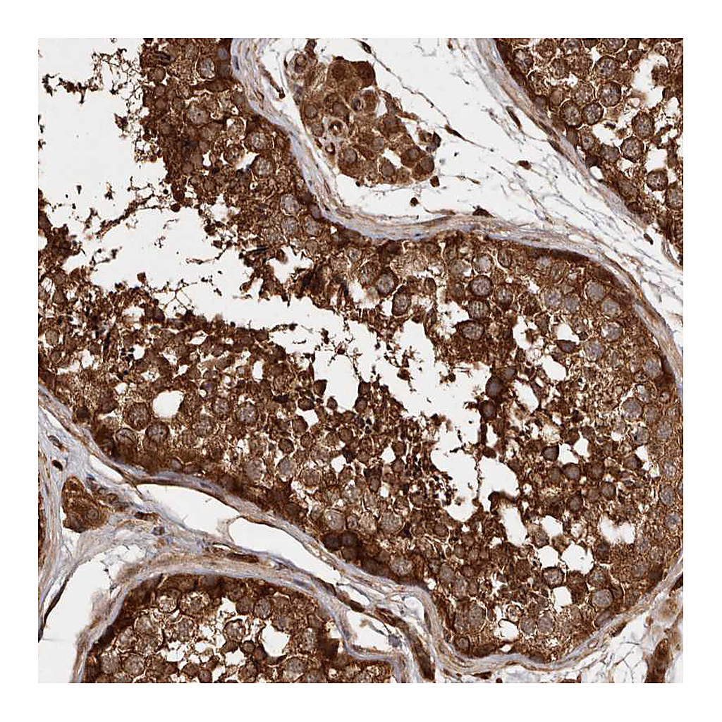 Atlas Antibodies Anti-STK36 Antibody