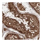 Atlas Antibodies Anti-STK36 Antibody