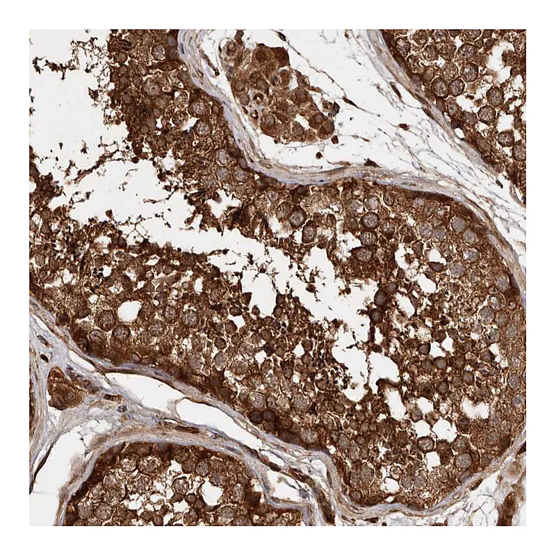 Atlas Antibodies Anti-STK36 Antibody