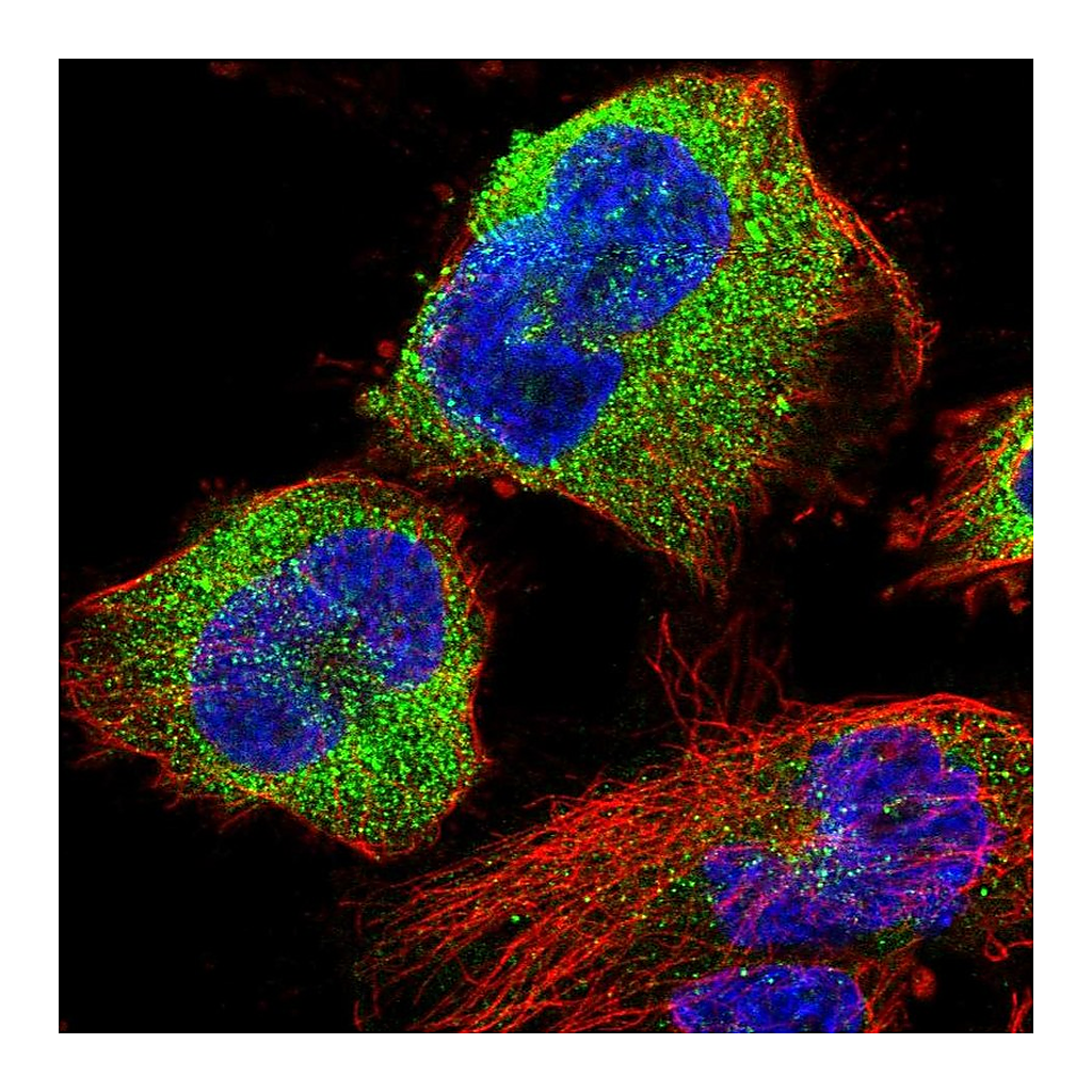 Atlas Antibodies Anti-STK38L Antibody