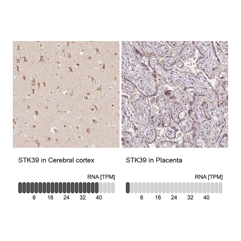 Atlas Antibodies Anti-STK39 Antibody