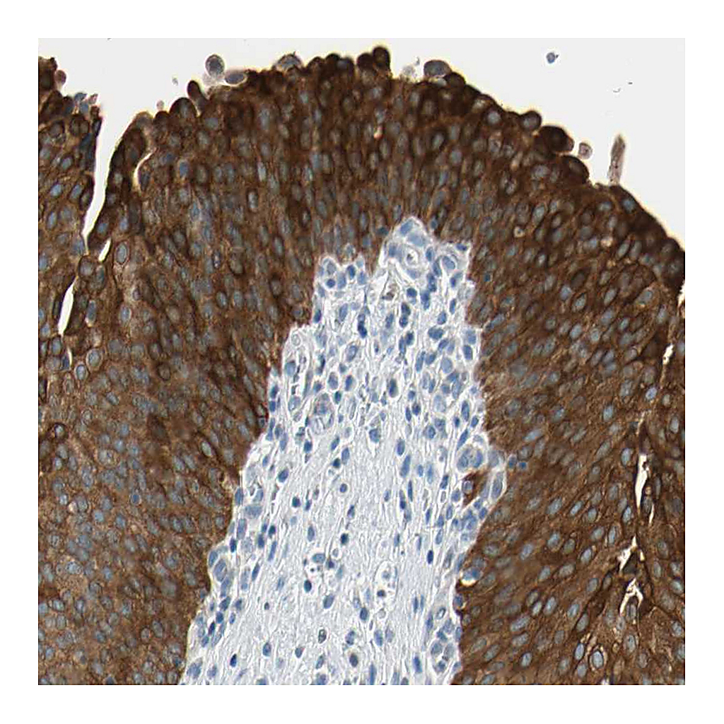 Atlas Antibodies Anti-STK40 Antibody