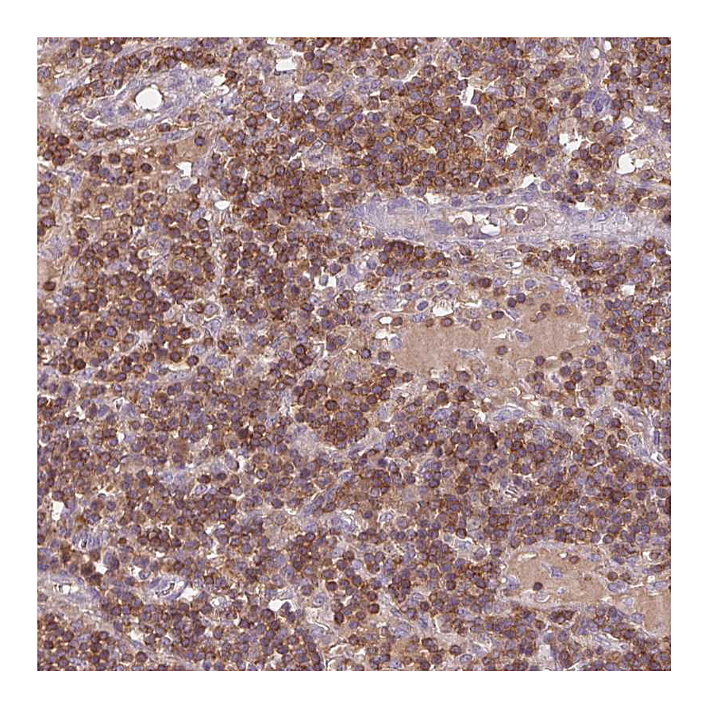Atlas Antibodies Anti-STK4 Antibody