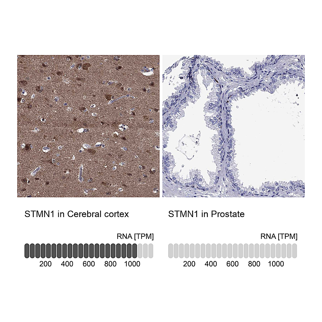 Atlas Antibodies Anti-STMN1 Antibody