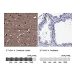 Atlas Antibodies Anti-STMN1 Antibody