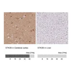 Atlas Antibodies Anti-STK39 Antibody