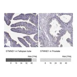 Atlas Antibodies Anti-STMND1 Antibody