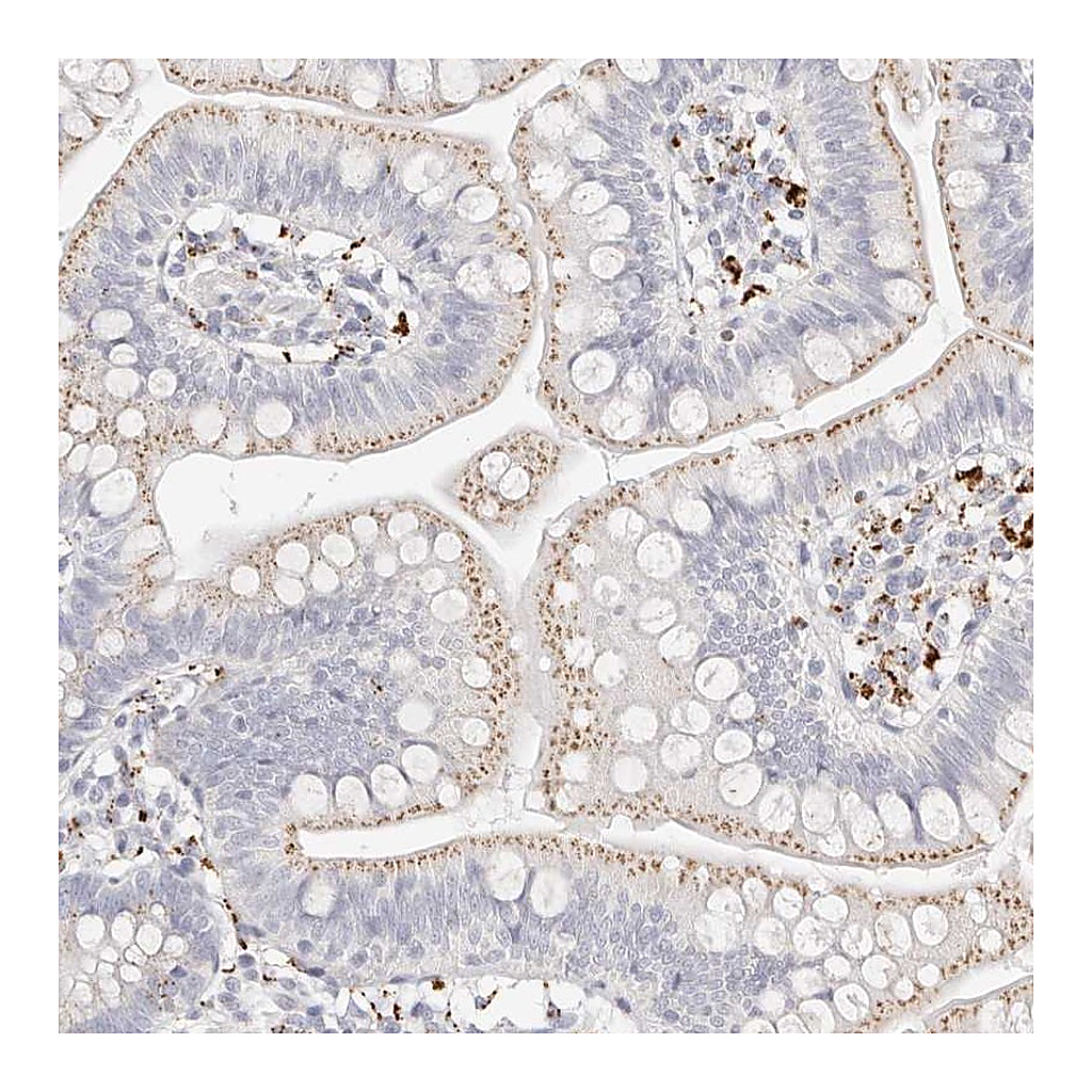 Atlas Antibodies Anti-STKLD1 Antibody