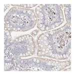 Atlas Antibodies Anti-STKLD1 Antibody