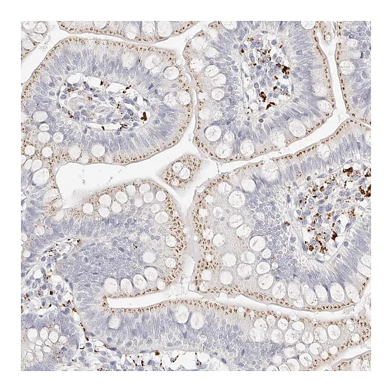 Atlas Antibodies Anti-STKLD1 Antibody