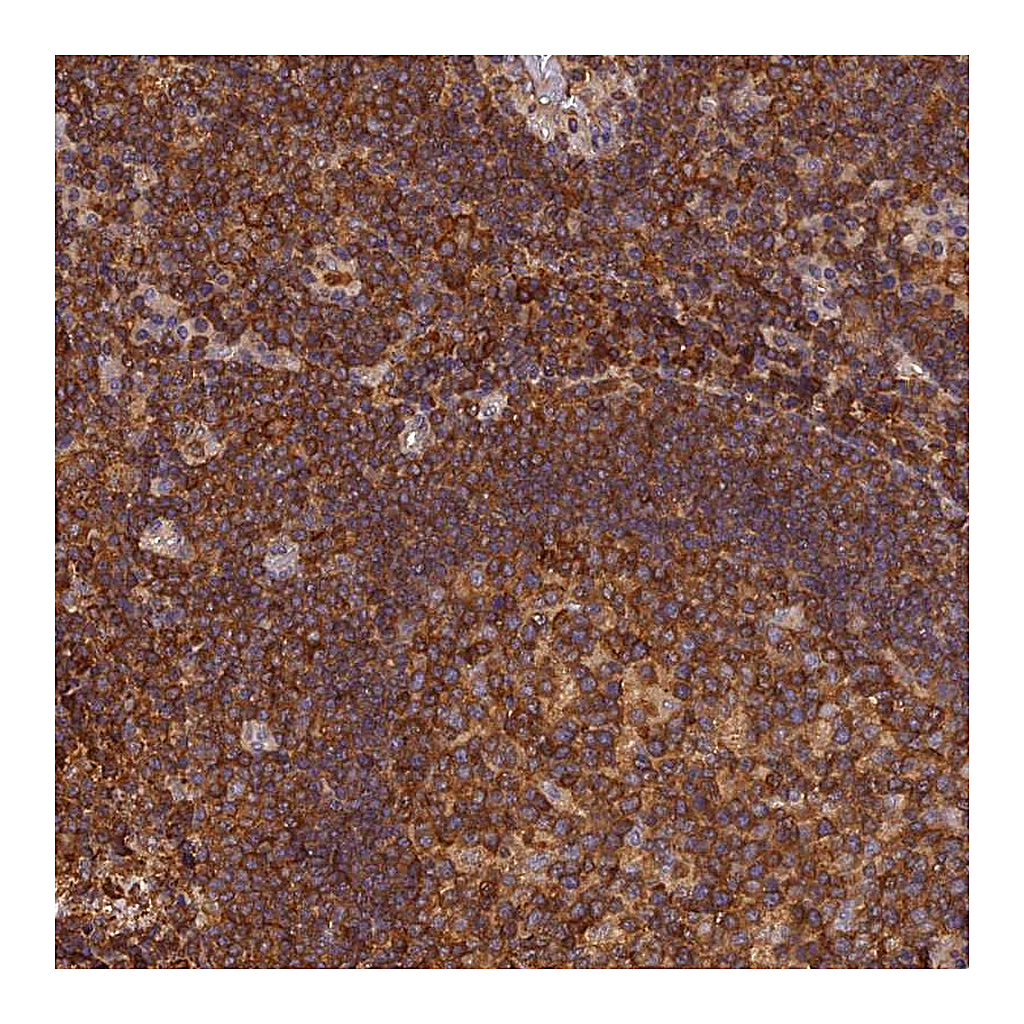 Atlas Antibodies Anti-STOML1 Antibody