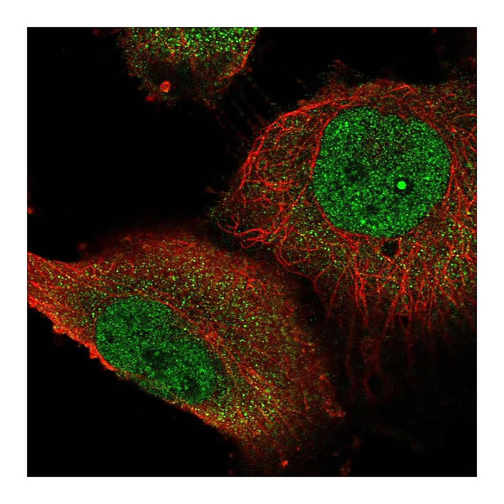 Atlas Antibodies Anti-STOX1 Antibody