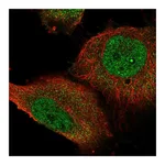 Atlas Antibodies Anti-STOX1 Antibody