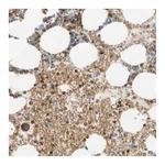 Atlas Antibodies Anti-STOM Antibody