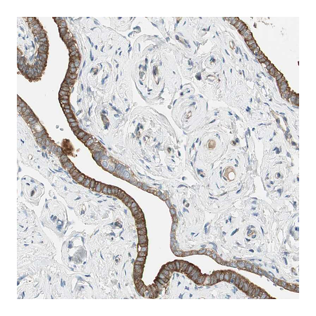 Atlas Antibodies Anti-STON1 Antibody