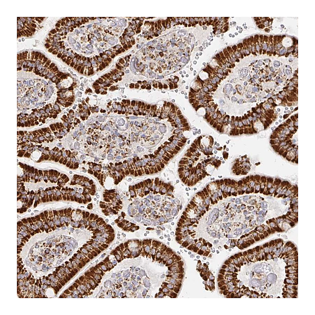 Atlas Antibodies Anti-STOML2 Antibody