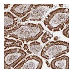 Atlas Antibodies Anti-STOML2 Antibody