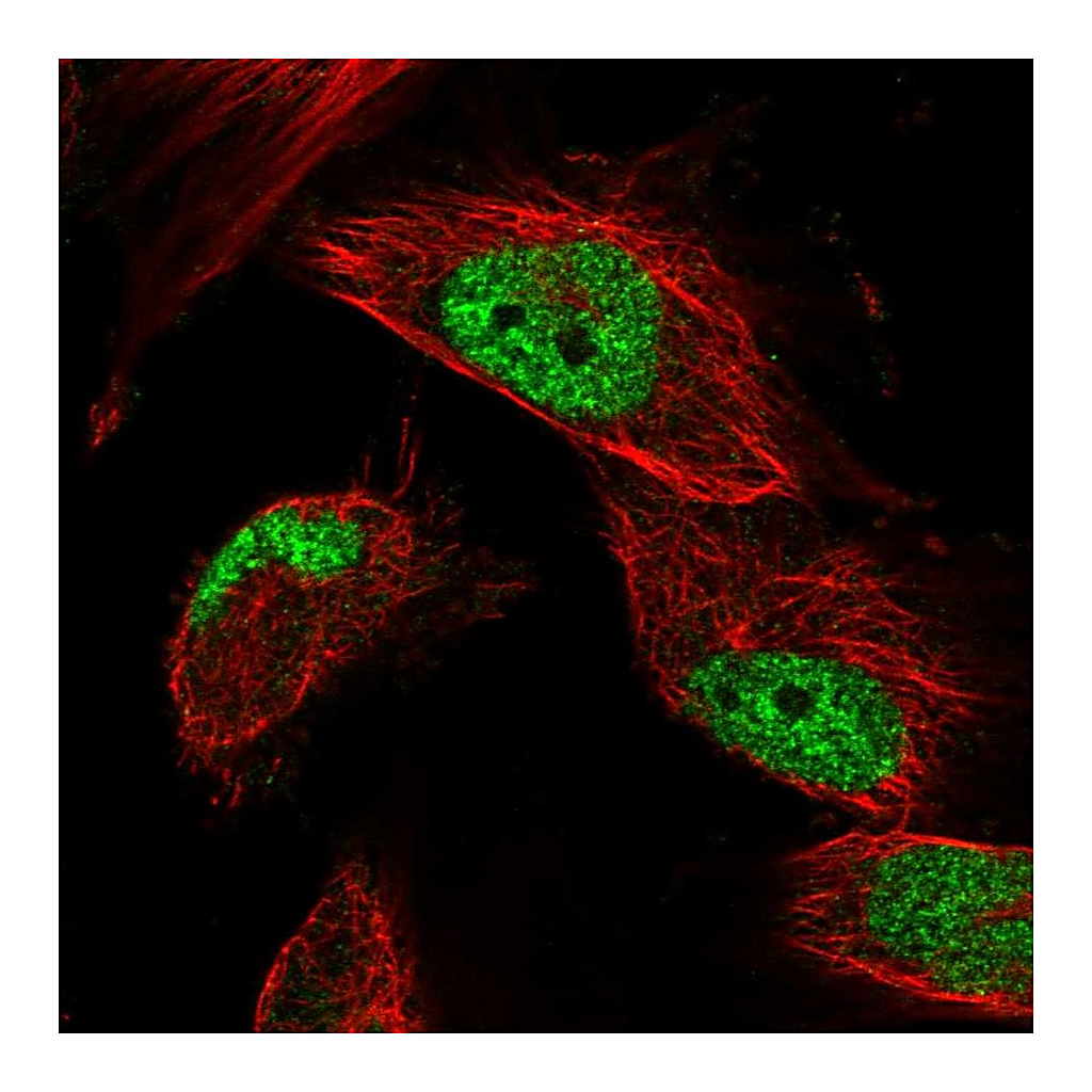 Atlas Antibodies Anti-STN1 Antibody