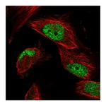 Atlas Antibodies Anti-STN1 Antibody