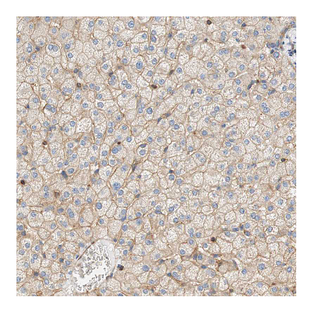 Atlas Antibodies Anti-STOM Antibody