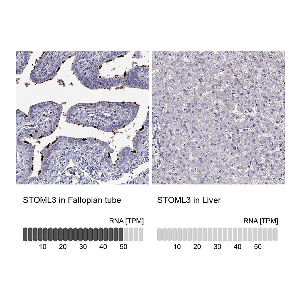 Atlas Antibodies Anti-STOML3 Antibody
