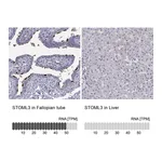 Atlas Antibodies Anti-STOML3 Antibody