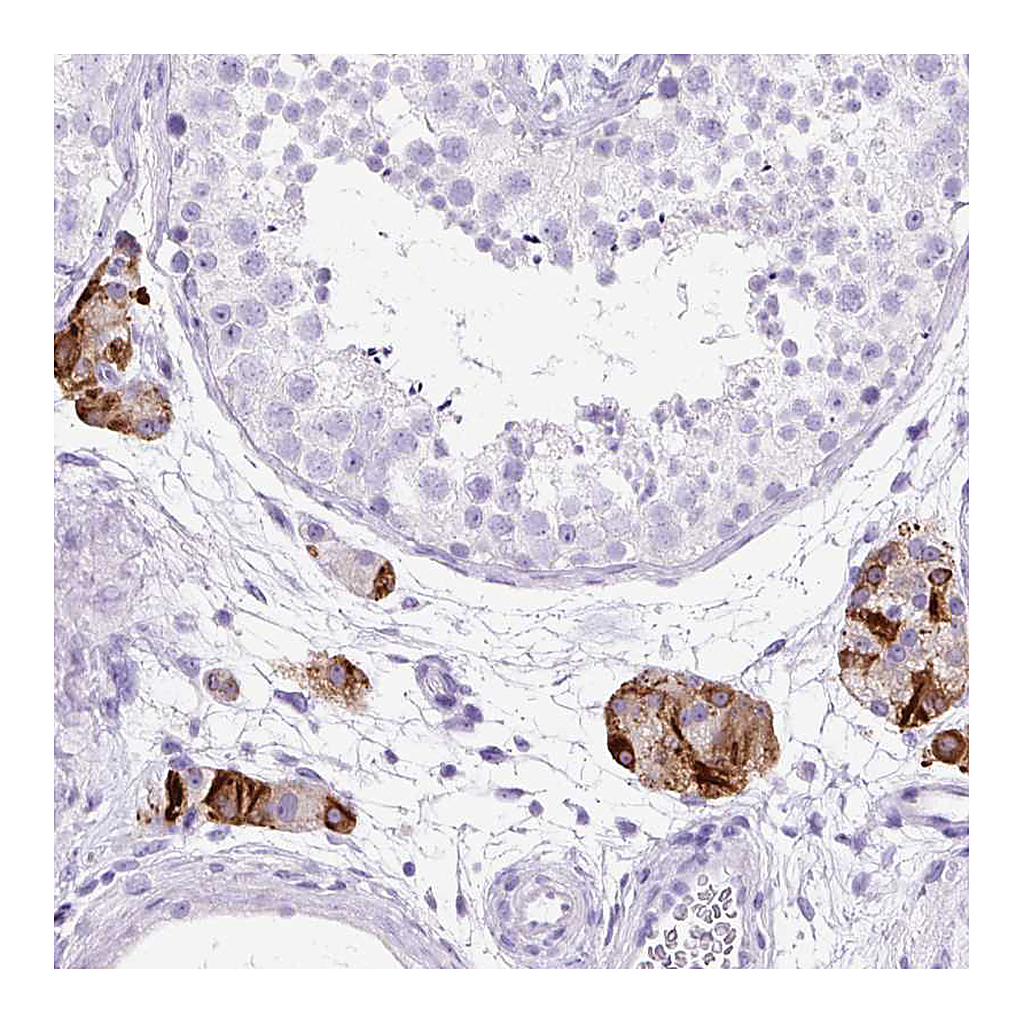 Atlas Antibodies Anti-STOX2 Antibody