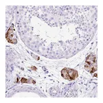 Atlas Antibodies Anti-STOX2 Antibody