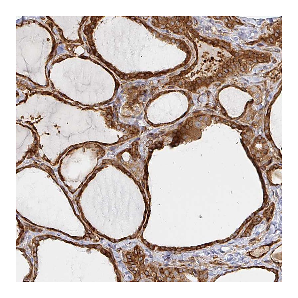 Atlas Antibodies Anti-STRAP Antibody