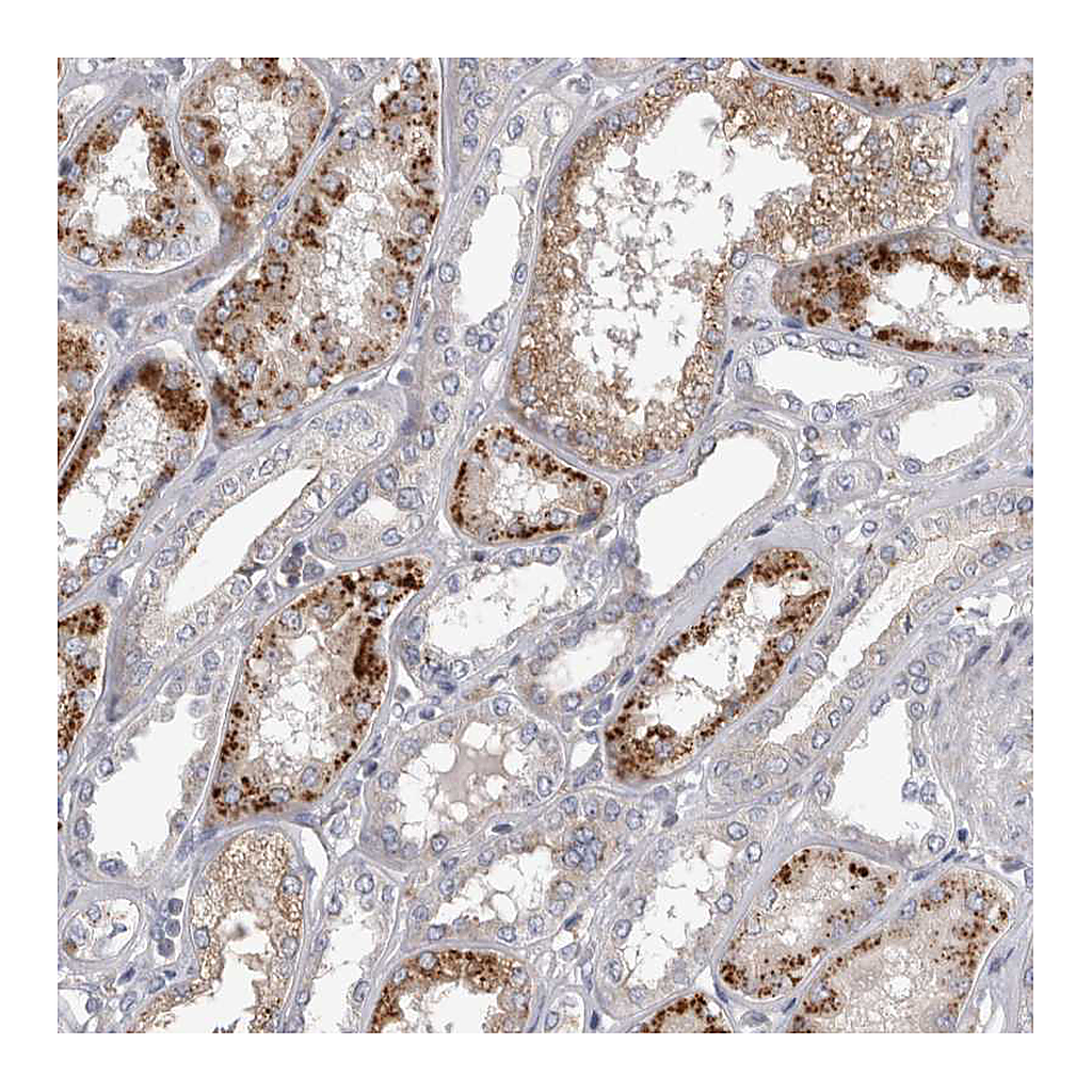 Atlas Antibodies Anti-STRADB Antibody