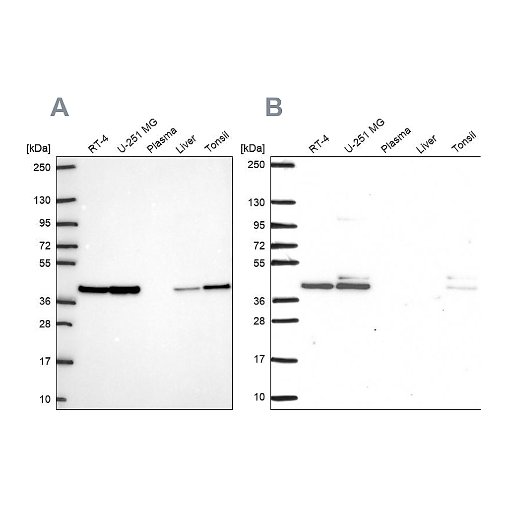 Atlas Antibodies Anti-STRAP Antibody