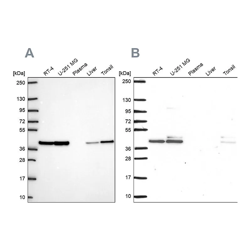 Atlas Antibodies Anti-STRAP Antibody