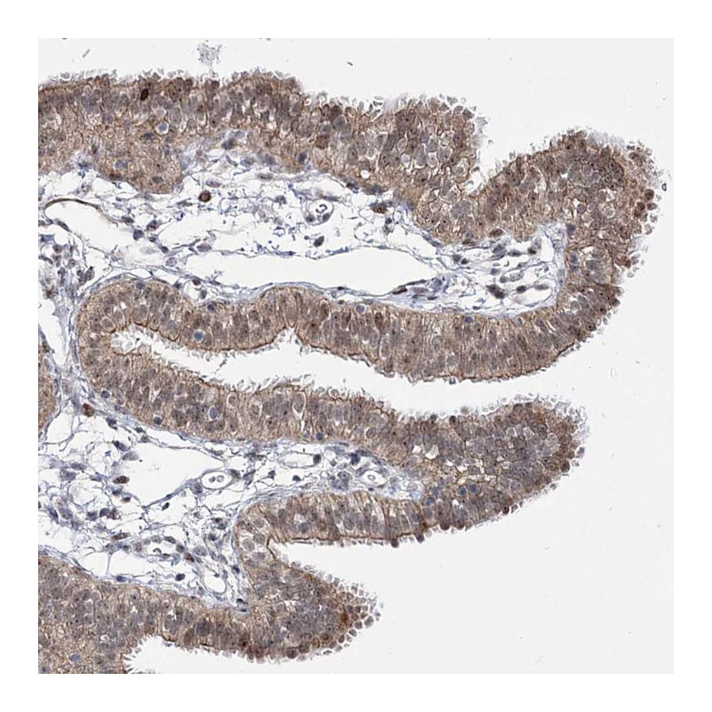 Atlas Antibodies Anti-STOX1 Antibody