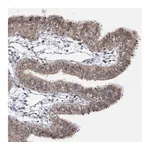 Atlas Antibodies Anti-STOX1 Antibody