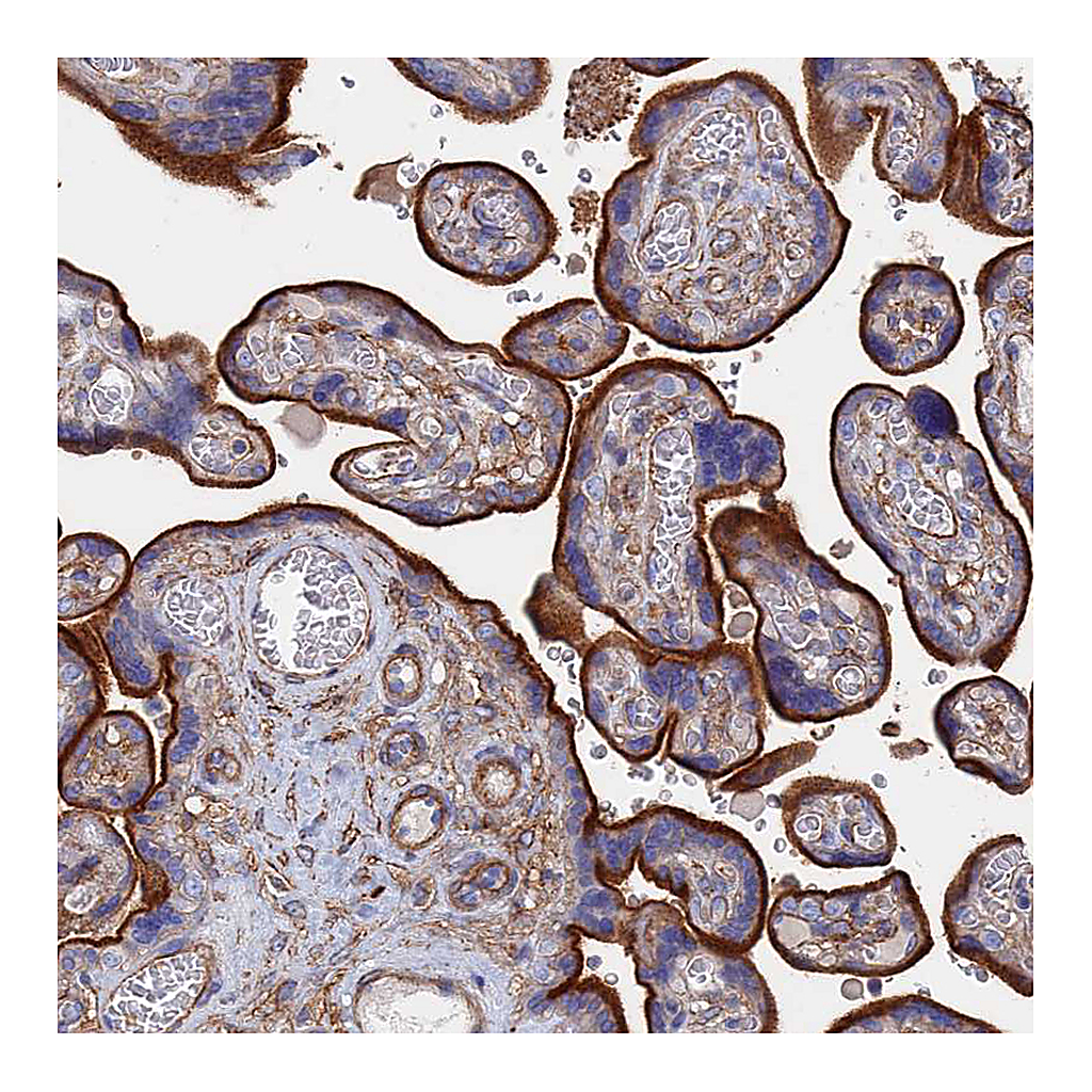 Atlas Antibodies Anti-STRA6 Antibody