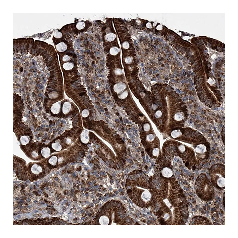 Atlas Antibodies Anti-STRADA Antibody