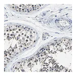 Atlas Antibodies Anti-STRBP Antibody