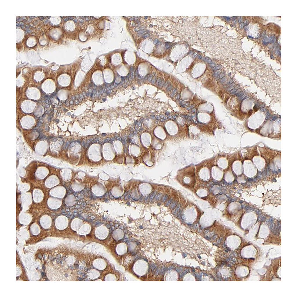 Atlas Antibodies Anti-STRN3 Antibody