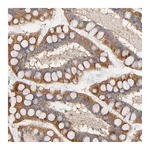 Atlas Antibodies Anti-STRN3 Antibody