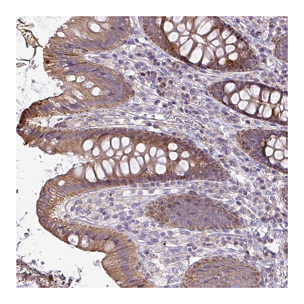 Atlas Antibodies Anti-STRIP1 Antibody