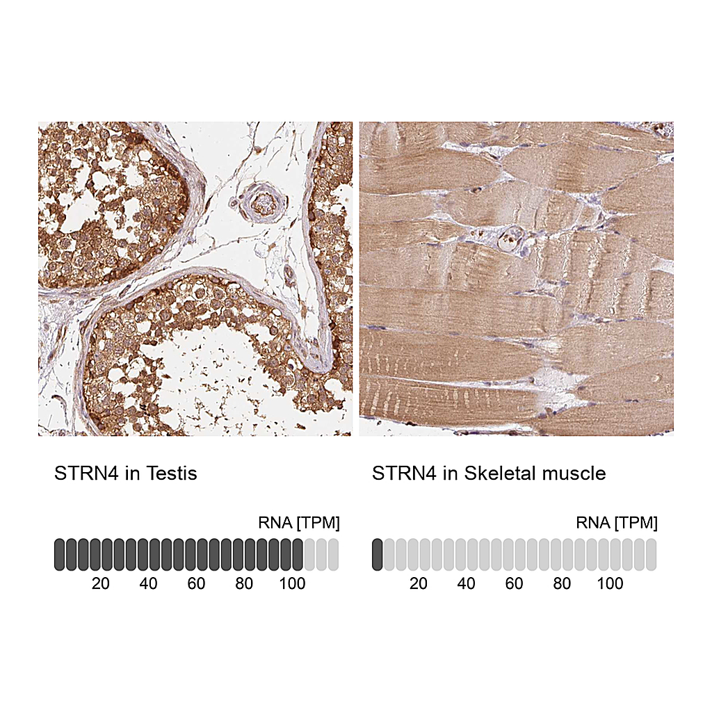 Atlas Antibodies Anti-STRN4 Antibody