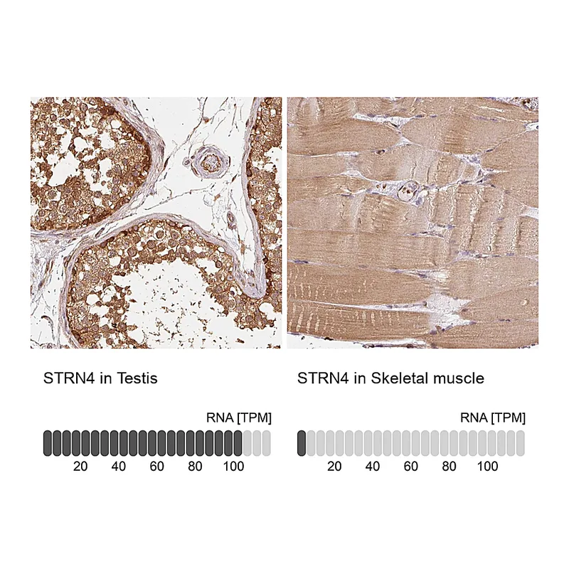 Atlas Antibodies Anti-STRN4 Antibody