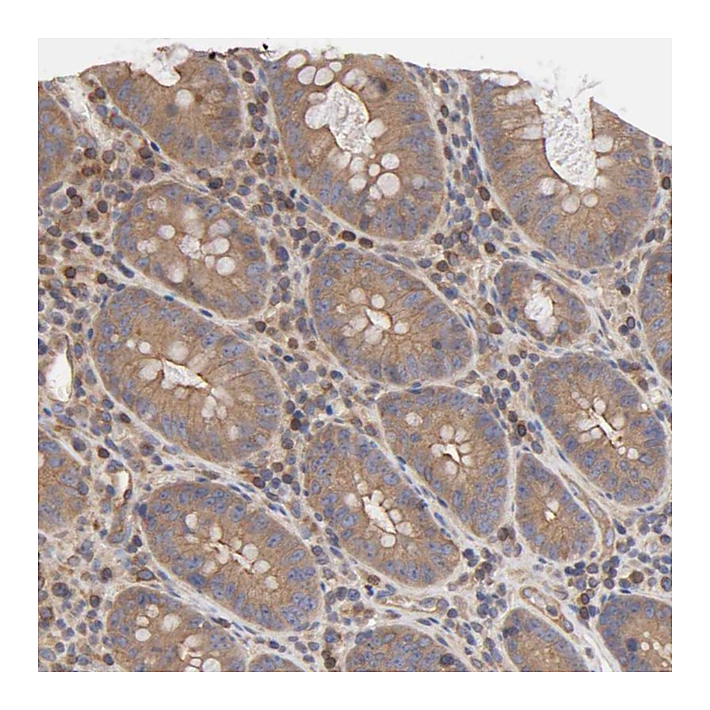 Atlas Antibodies Anti-STRN3 Antibody