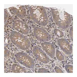 Atlas Antibodies Anti-STRN3 Antibody